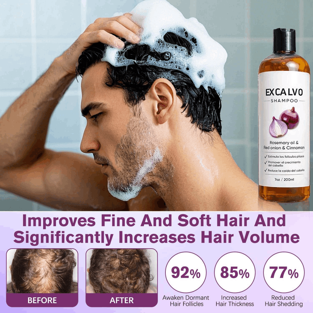 200ml Rosemary & Red Onion Ant - огляд і ціна Purple Toning Shampoo
