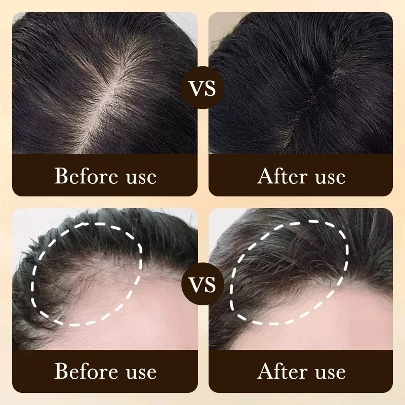 Biotin Fast Hair Growth Oil Pr - огляд і ціна Hair Care Vegan