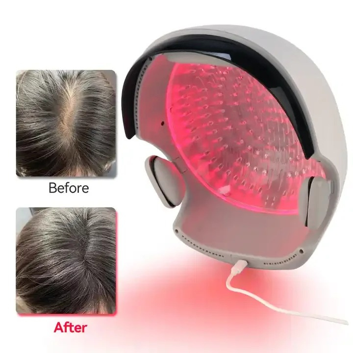 Red‑Light Hair Growth Helmet,  - огляд і ціна Hair Care Lab