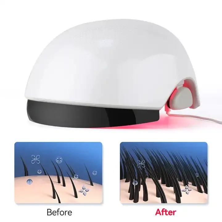 Red‑Light Hair Growth Helmet,  - огляд і ціна Hair Care Lab